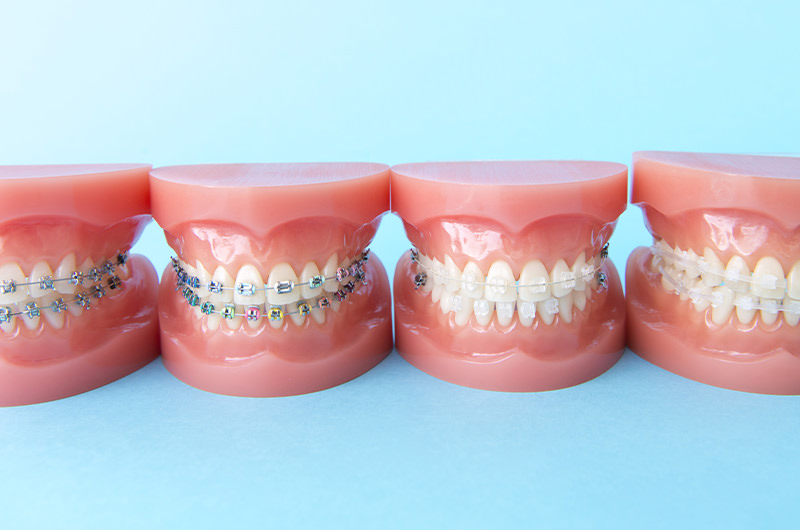 マルチブラケット