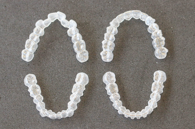 インビザライン